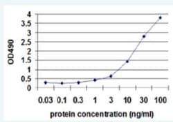 SPINK1 Antibody Pair, Novus Biologicals 1 Set | Buy Online | Novus Biologicals | Fisher Scientific