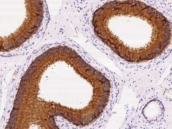 SPINK2 Antibody, Novus Biologicals 100 &mu;g, Unconjugated:Antibodies,