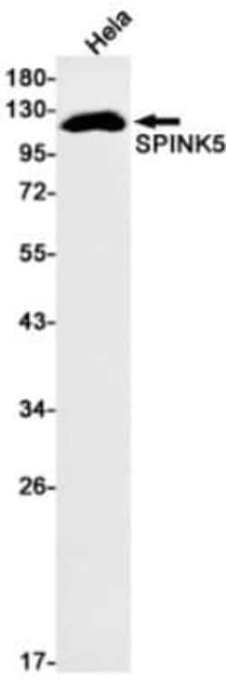 SPINK5 Antibody (S06-6C1), Novus Biologicals 50 &mu;g; Unconjugated:Antibodies,