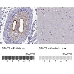 SPINT3 Antibody, Novus Biologicals 25ul; Unconjugated:Antibodies, Polyclonal