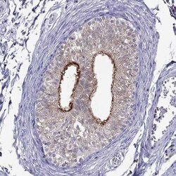 SPINT3 Antibody, Novus Biologicals 25ul; Unconjugated:Antibodies, Polyclonal