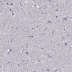 SPINT3 Antibody, Novus Biologicals 25ul; Unconjugated:Antibodies, Polyclonal