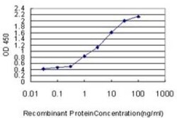 SPIRE1 Antibody (4C5), Novus Biologicals 0.1 mg | Buy Online | Novus Biologicals | Fisher Scientific