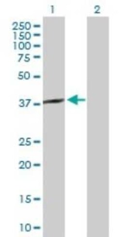 SPO11 Antibody, Novus Biologicals 0.1 mg | Buy Online | Novus Biologicals | Fisher Scientific