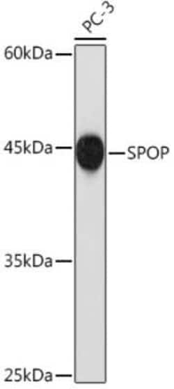 SPOP Rabbit anti-Human, Clone: 2N8L8, Novus Biologicals 100 &mu;g; Unconjugated:Antibodies,