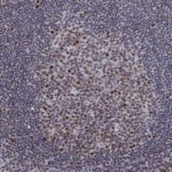 SPOUT1 Rabbit anti-Human, Polyclonal, Novus Biologicals:Antibodies:Primary