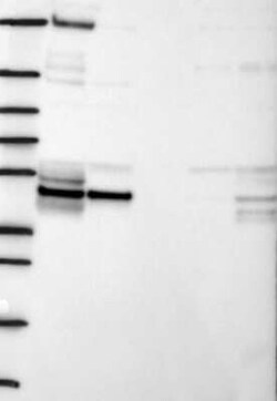 SPOUT1 Rabbit anti-Human, Polyclonal, Novus Biologicals:Antibodies:Primary
