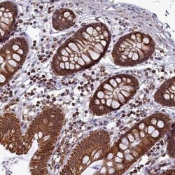 SPR Antibody, Novus Biologicals 25 &mu;L | Buy Online | Novus Biologicals | Fisher Scientific