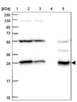 SPR Antibody, Novus Biologicals 25 &mu;L | Buy Online | Novus Biologicals | Fisher Scientific