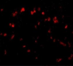 SPRED1 Antibody - BSA Free, Novus Biologicals 0.1 mg; Unconjugated:Antibodies,