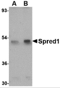SPRED1 Antibody - BSA Free, Novus Biologicals 0.1 mg | Buy Online | Novus Biologicals | Fisher Scientific