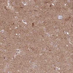 SPRED2 Antibody, Novus Biologicals:Antibodies:Primary Antibodies