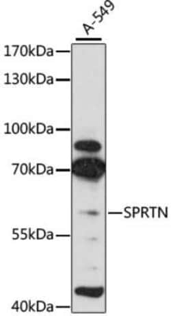 SPRTN Antibody - Azide and BSA Free, Novus Biologicals 0.02 mL; Unconjugated:Antibodies,