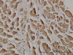 SPRY1 Antibody (3H4), Novus Biologicals 0.1 mg | Buy Online | Novus Biologicals | Fisher Scientific