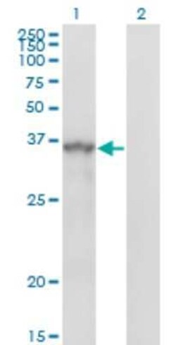 SPRY1 Antibody (3H4), Novus Biologicals 0.1 mg | Buy Online | Novus Biologicals | Fisher Scientific