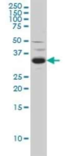 Novus Biologicals SPRY2 Antibody (1E10), Novus Biologicals 0.1 mg, Unconjugated:Antibodies,