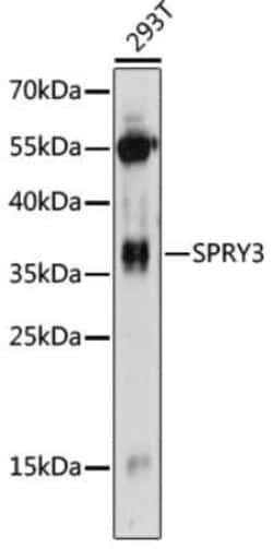 SPRY3 Antibody - Azide and BSA Free, Novus Biologicals 0.1 mL; Unconjugated:Antibodies,