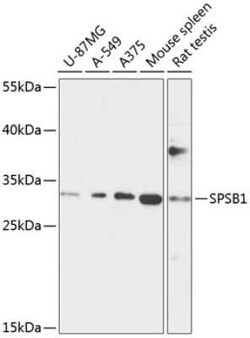 SPSB1 Antibody - Azide and BSA Free, Novus Biologicals:Antibodies:Primary