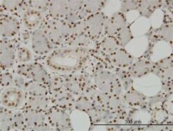 SPSB2 Antibody (1E6), Novus Biologicals 0.1 mg; Unconjugated:Antibodies,