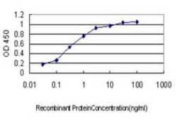 SPSB2 Antibody (1E6), Novus Biologicals 0.1 mg; Unconjugated:Antibodies,