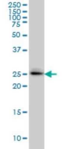 SPSB2 Antibody (1E6), Novus Biologicals 0.1 mg; Unconjugated:Antibodies,