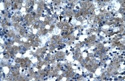 SPT3 Rabbit anti-Human, Polyclonal, Novus Biologicals 0.1 mL; Unconjugated:Antibodies,