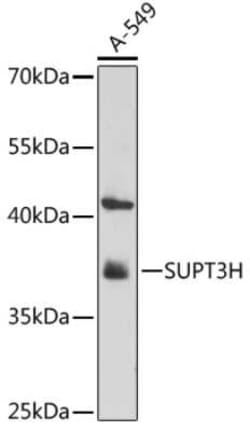 SPT3 Antibody - Azide and BSA Free, Novus Biologicals 0.02 mL; Unconjugated:Antibodies,