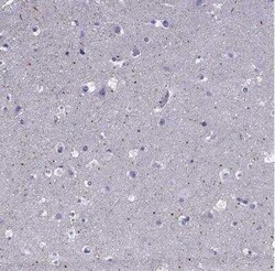 SPTBN4 Antibody, Novus Biologicals:Antibodies:Primary Antibodies