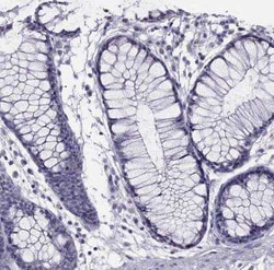 SPTBN4 Antibody, Novus Biologicals:Antibodies:Primary Antibodies