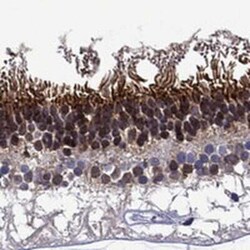 SPTBN5 Rabbit anti-Human, Polyclonal, Novus Biologicals:Antibodies:Primary