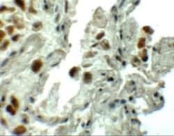 SPTLC1 Antibody - BSA Free, Novus Biologicals 0.1 mg; Unconjugated:Antibodies,