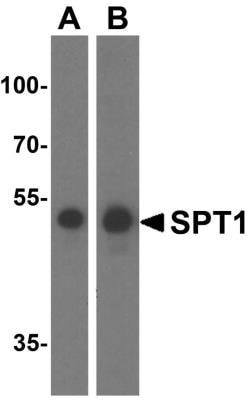 SPTLC1 Antibody - BSA Free, Novus Biologicals 0.1 mg; Unconjugated:Antibodies,