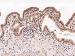SQLE Antibody, Novus Biologicals:Anticuerpos:Anticuerpos primarios