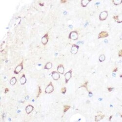 SR-AI/MSR Rabbit anti-Human, Mouse, Rat, Clone: 10O8B0, Novus Biologicals 20 &mu;g | Buy Online | Novus Biologicals | Fisher Scientific
