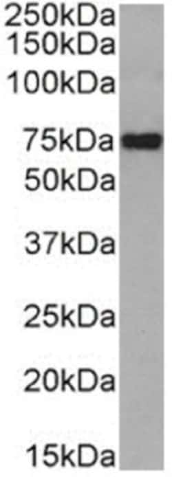 SR-BI Rabbit anti-Human, Clone: 185-1G2 (B467), Novus Biologicals:Antibodies:Primary