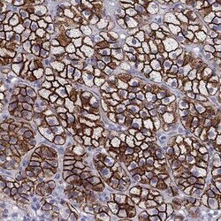 SR-BI Antibody, Novus Biologicals 25ul; Unconjugated:Antibodies, Polyclonal