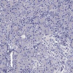 SR-BI Antibody, Novus Biologicals 25ul; Unconjugated:Antibodies, Polyclonal
