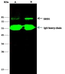 SR-BI Antibody, Novus Biologicals:Antibodies:Primary Antibodies