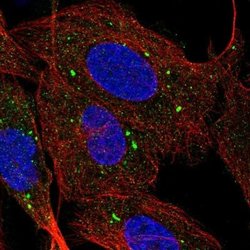 SR-BI Antibody, Novus Biologicals 100&mu;L; Unlabeled:Antibodies, Polyclonal