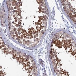 SRA1 Antibody, Novus Biologicals:Antibodies:Primary Antibodies