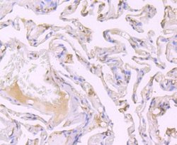 SRC1 Rabbit anti-Human, Clone: JB66-31, Novus Biologicals 100 &mu;l; Unconjugated:Antibodies,