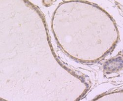 SRC1 Rabbit anti-Human, Clone: JB66-31, Novus Biologicals 100 &mu;l; Unconjugated:Antibodies,