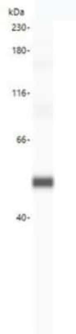 SRD5A1 Antibody, Novus Biologicals 50 &mu;g | Buy Online | Novus Biologicals | Fisher Scientific