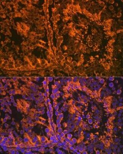 SRD5A2 Rabbit anti-Human, Mouse, Rat, Clone: 8A4H5, Novus Biologicals 20