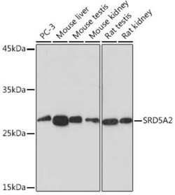 SRD5A2 Rabbit anti-Human, Mouse, Rat, Clone: 8A4H5, Novus Biologicals 20