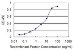 SRD5A2 Antibody (1F4), Novus Biologicals 0.1 mg; Unconjugated:Antibodies,