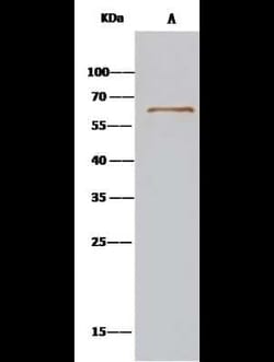 SRFBP1 Antibody, Novus Biologicals 100 &mu;g; Unconjugated:Antibodies,