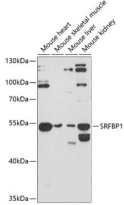 SRFBP1 Antibody - Azide and BSA Free, Novus Biologicals 0.02 mL | Buy Online | Novus Biologicals | Fisher Scientific