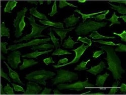 SRGAP1 Antibody (5D10), Novus Biologicals 0.1 mg; Unconjugated:Antibodies,