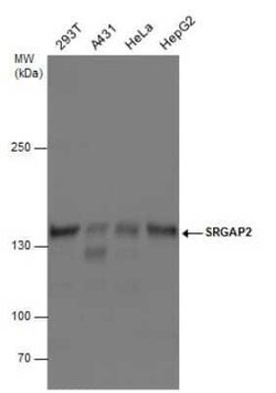 SRGAP2 Antibody, Novus Biologicals 100 &mu;g | Buy Online | Novus Biologicals | Fisher Scientific